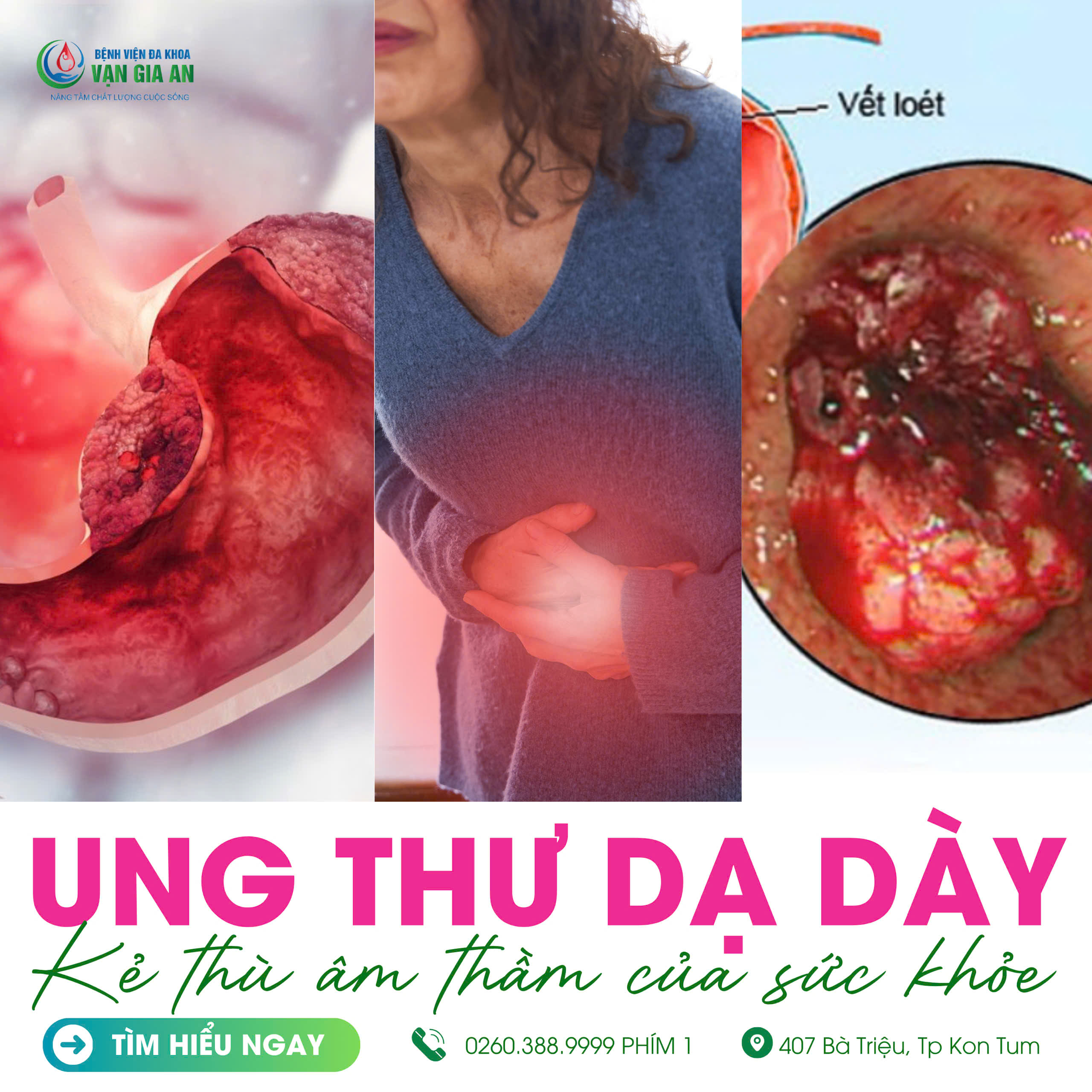Ảnh nội soi dạ dày tại BV Vạn Gia An, Chuyên gia tư vấn tầm soát ung thư dạ dày