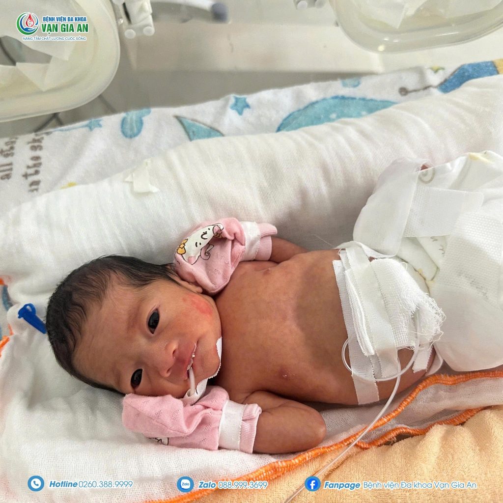 Cham-soc-tre-sinh-non-1kg5-Van-Gia-An.